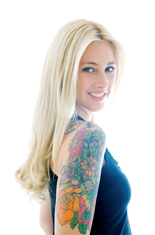 Rapid Laser Tattoo Removal