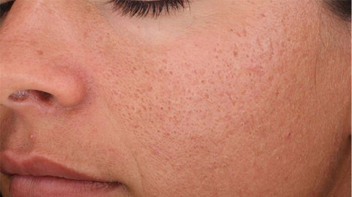 SkinMedica Vitalize Before and After