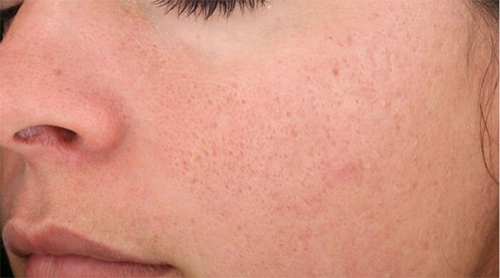 SkinMedica Vitalize Before and After