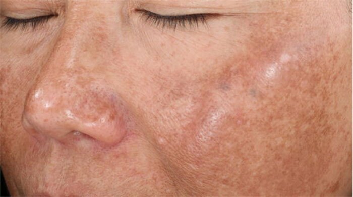 SkinMedica Vitalize Before and After